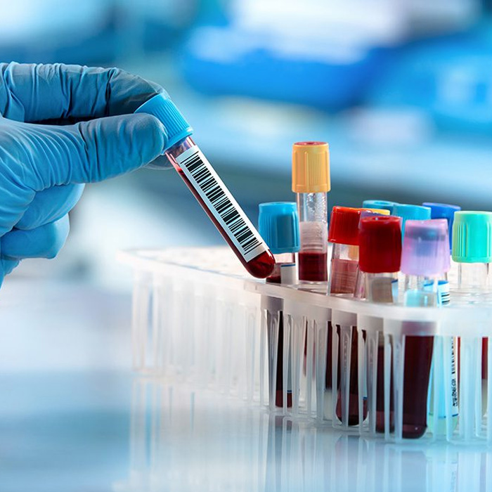 Hemato Oncology Testing Market Global outlook 2024 to 2031