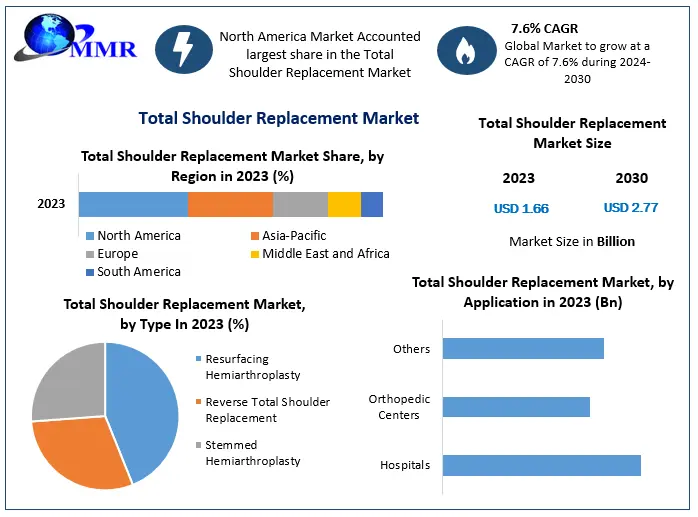 Total Shoulder Replacement Market Expected to Reach USD 2.77 Billion by 2030, Growing at a 7.6 Percentage CAGR