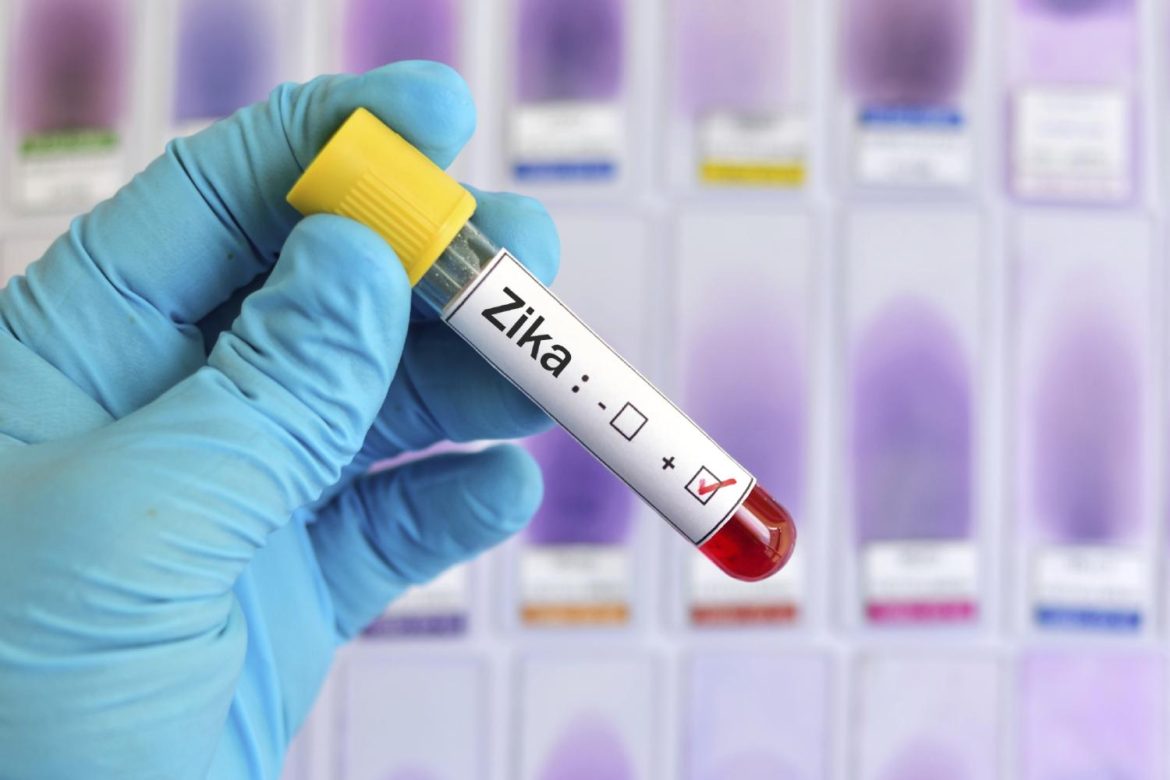 Zika Virus Testing Market Is Booming Worldwide | ELITechGroup, Genekam, Luminex